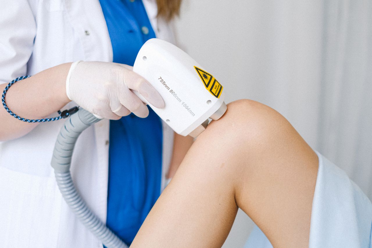 laser tattoo removal