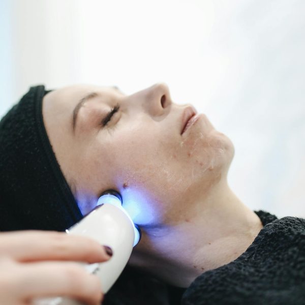acne defense acne defense