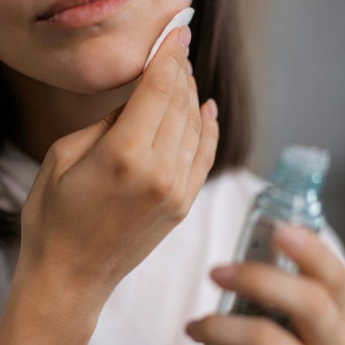 derma peel recovery derma peel recovery